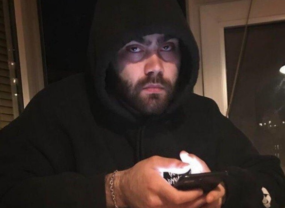Возможно, Jeembo ударили по лицу в уличных разборках​Фото: Instagram
