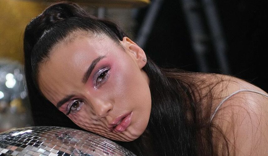 MOLLY​Фото: Instagram