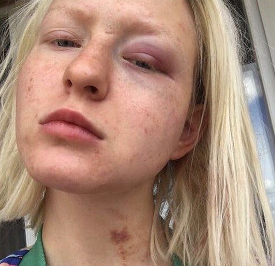 Тося ЧайкинаФото: Instagram